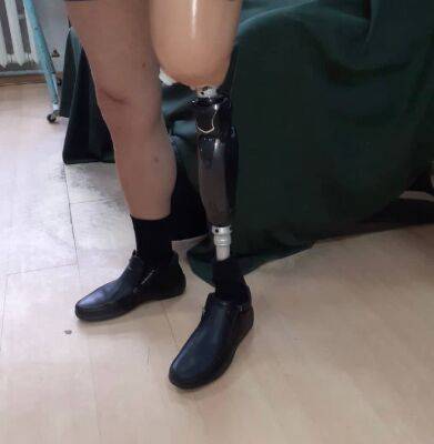 В Твери потерявшему ногу человеку сделали протез за 3,5 млн рублей - afanasy.biz - Тверь - Тверская обл.
